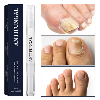 💅 Körömgomba kezelő toll - sérült és megsárgult körmökhöz